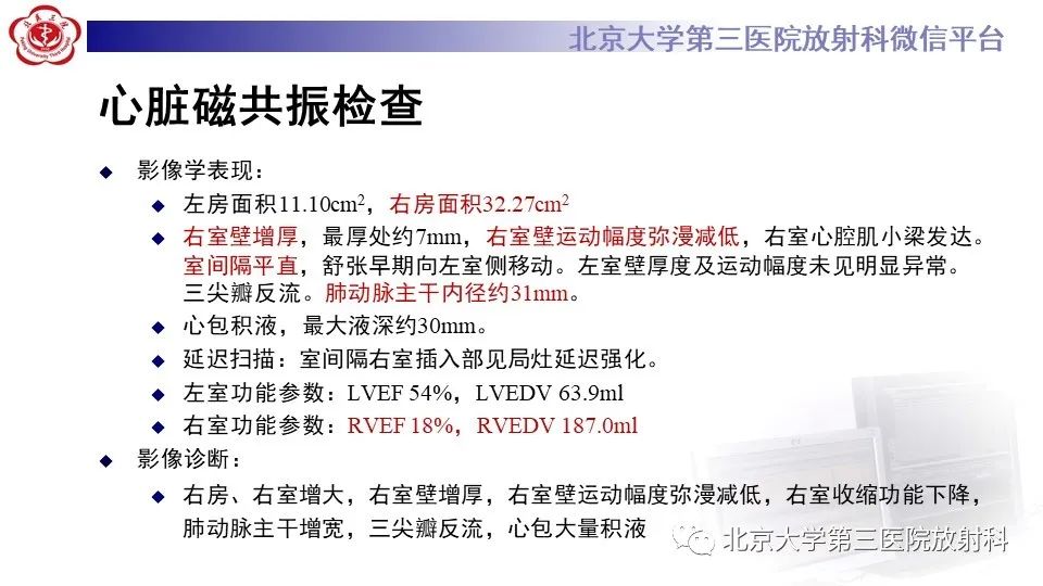 影像PPT - 【PPT】肺动脉高压的影像评估-9