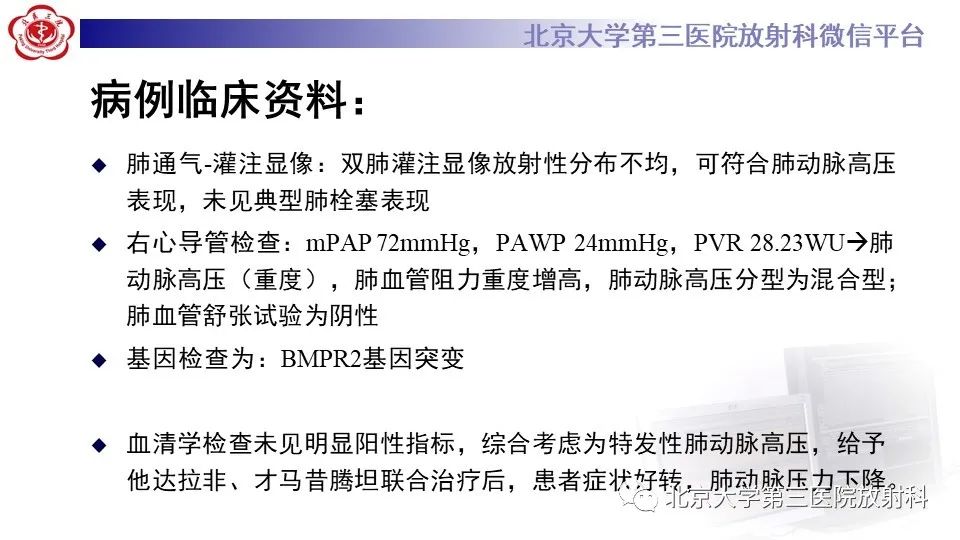 影像PPT - 【PPT】肺动脉高压的影像评估-10