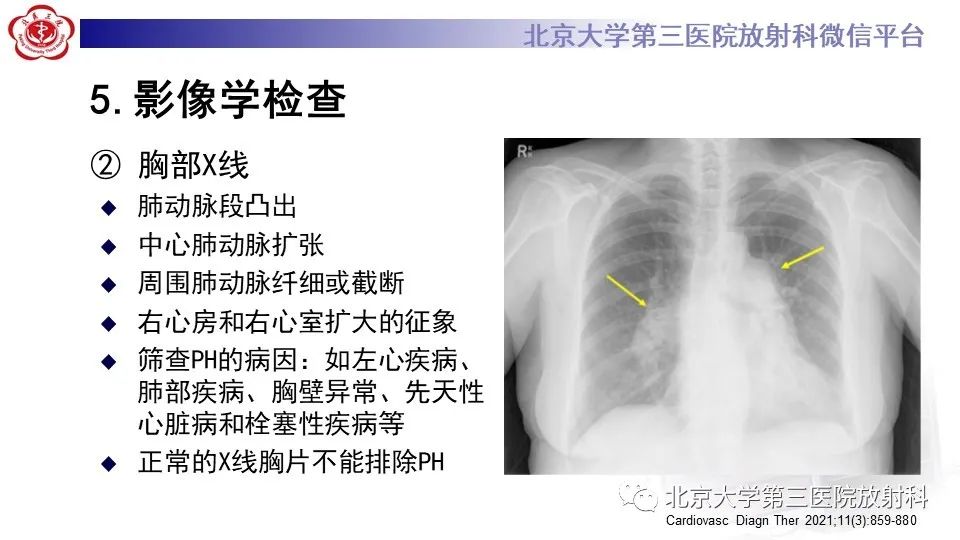 影像PPT - 【PPT】肺动脉高压的影像评估-22