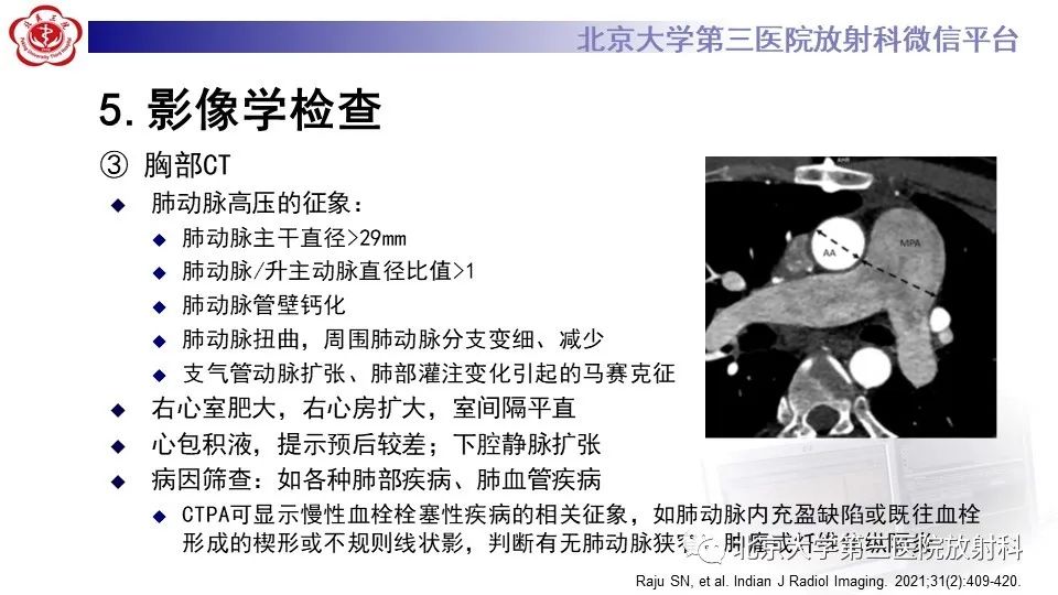 影像PPT - 【PPT】肺动脉高压的影像评估-23