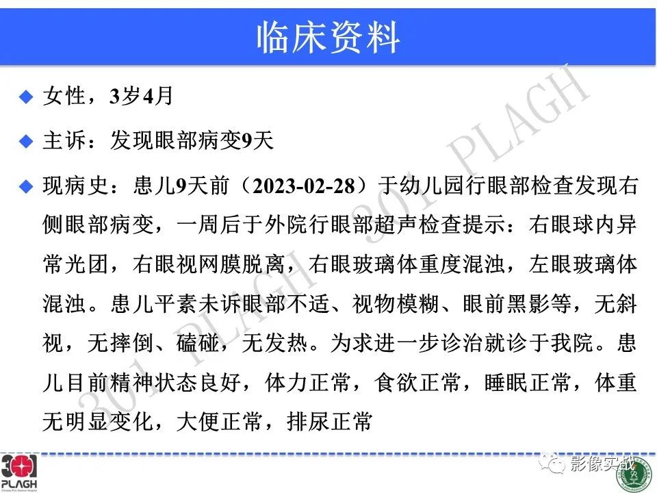 影像PPT - 【病例】视网膜母细胞瘤1例MR影像-2