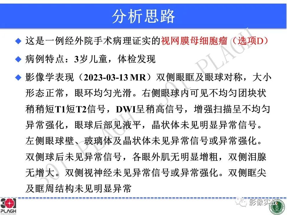 影像PPT - 【病例】视网膜母细胞瘤1例MR影像-15