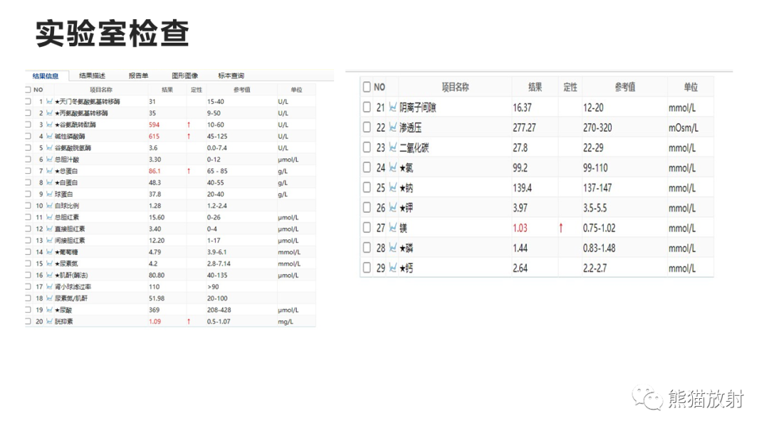影像PPT - 【病例】肝细胞腺瘤HCA VS 肝脏局灶性结节性增生FNH-3