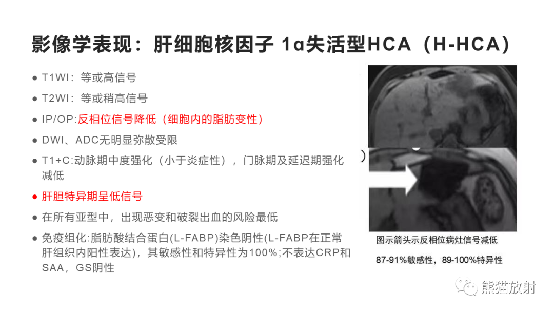 影像PPT - 【病例】肝细胞腺瘤HCA VS 肝脏局灶性结节性增生FNH-20