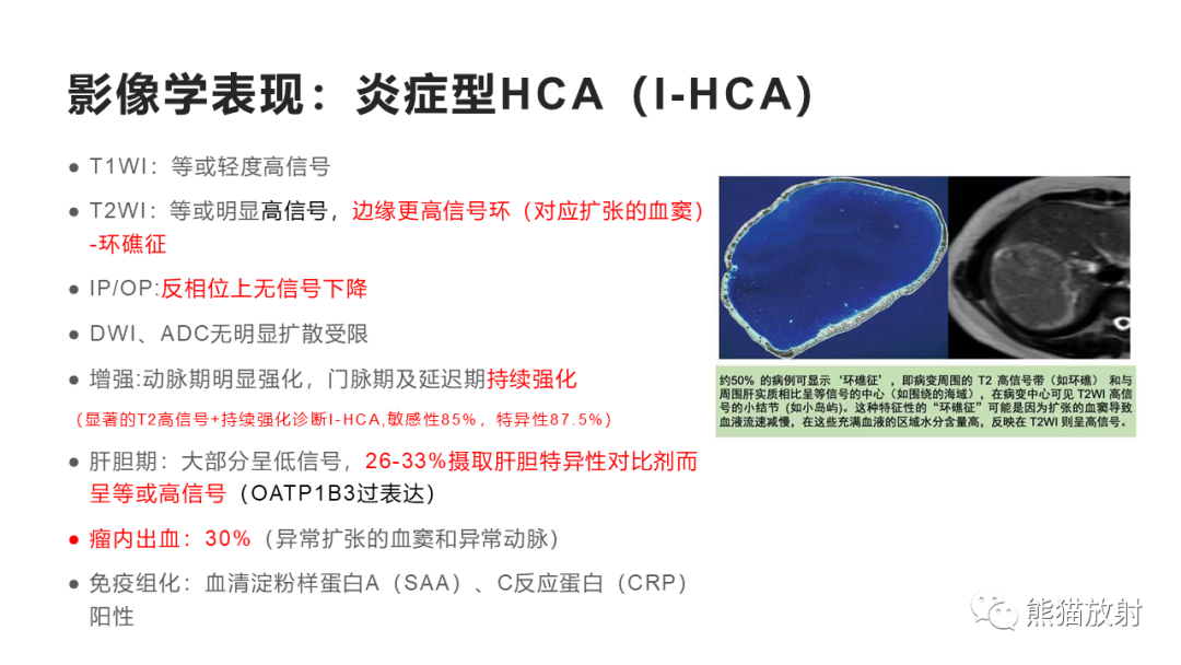 影像PPT - 【病例】肝细胞腺瘤HCA VS 肝脏局灶性结节性增生FNH-23