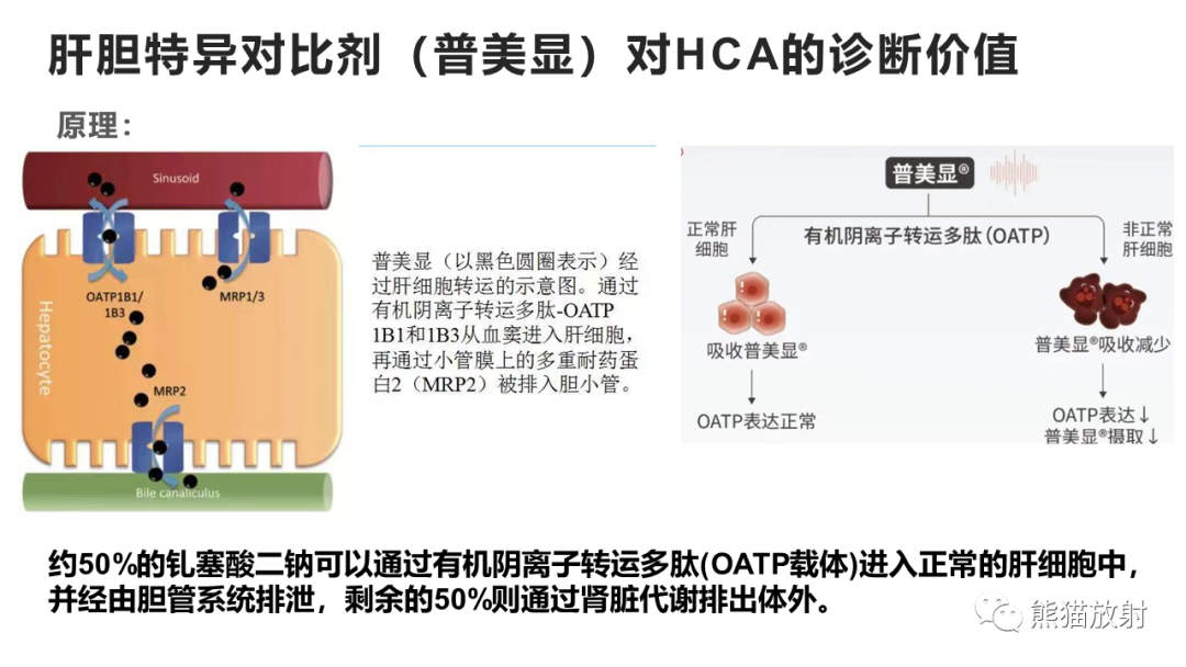 影像PPT - 【病例】肝细胞腺瘤HCA VS 肝脏局灶性结节性增生FNH-29