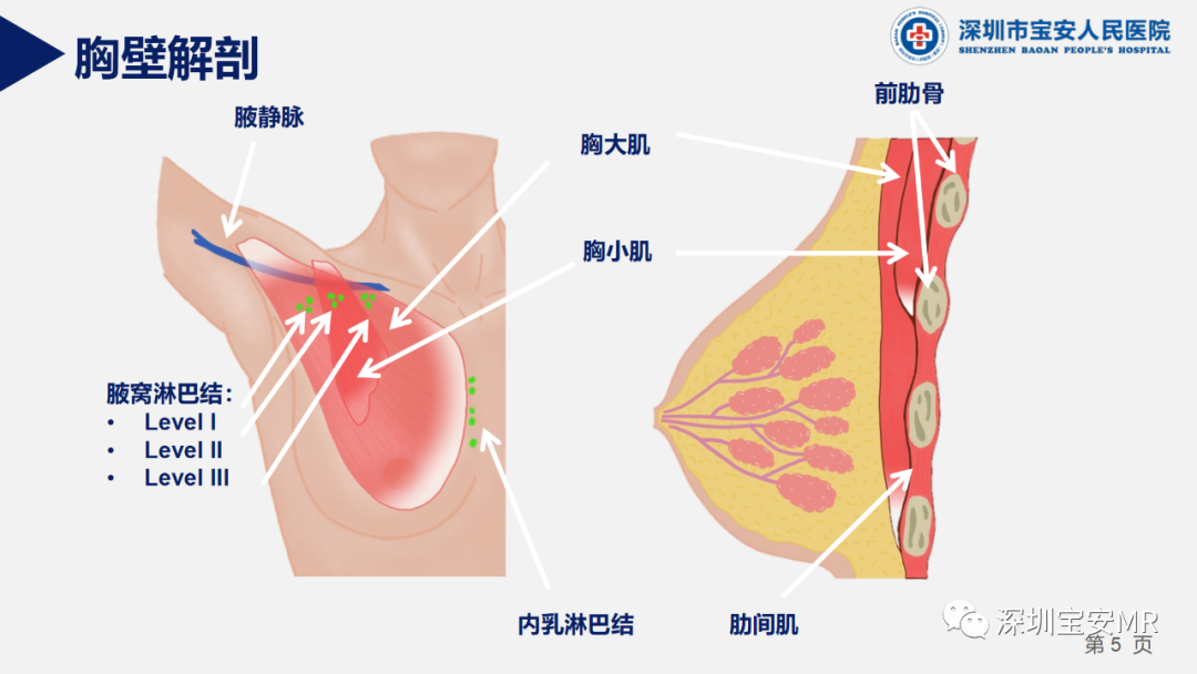 影像PPT - 【PPT】胸壁病变的影像诊断-5