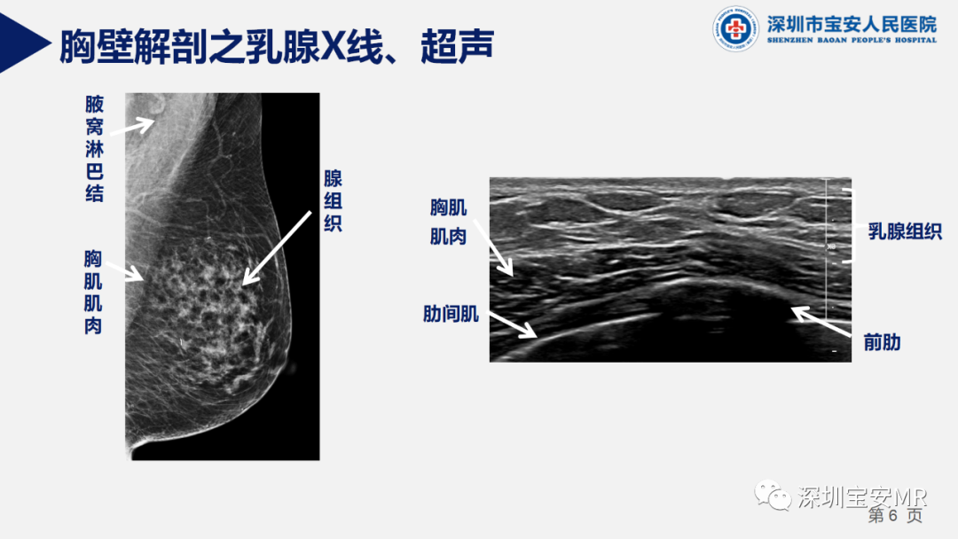 影像PPT - 【PPT】胸壁病变的影像诊断-6