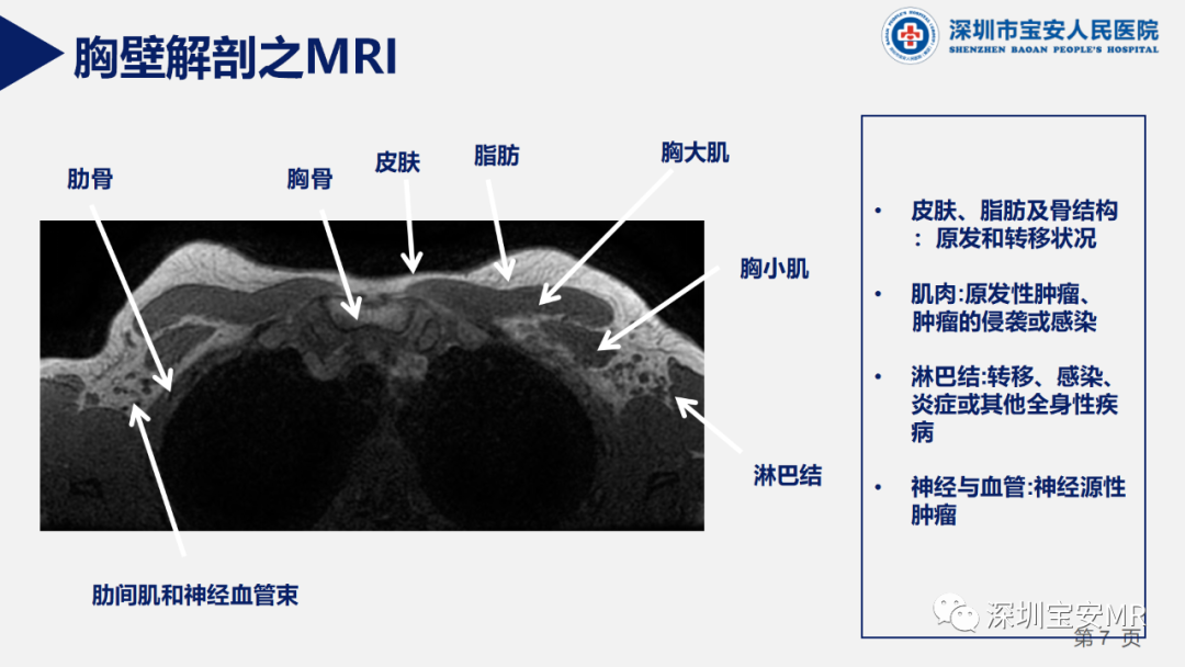 影像PPT - 【PPT】胸壁病变的影像诊断-7