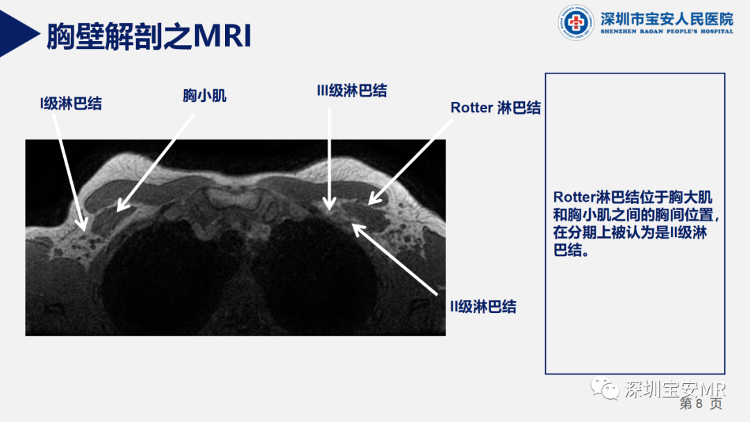 影像PPT - 【PPT】胸壁病变的影像诊断-8