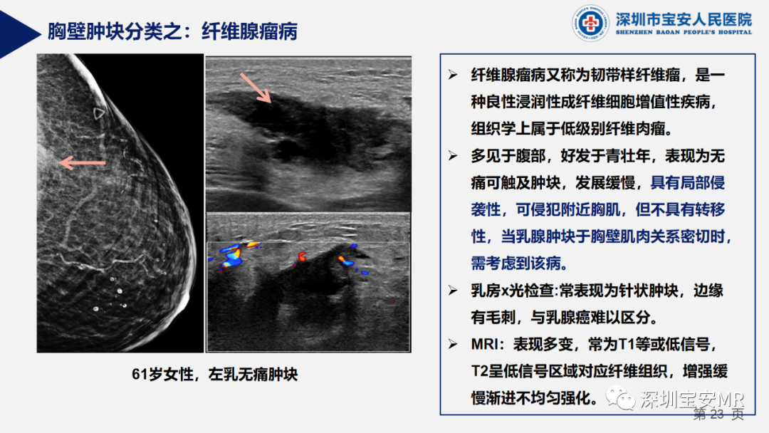影像PPT - 【PPT】胸壁病变的影像诊断-23
