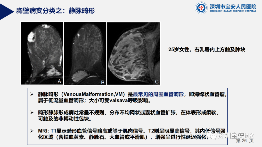 影像PPT - 【PPT】胸壁病变的影像诊断-26