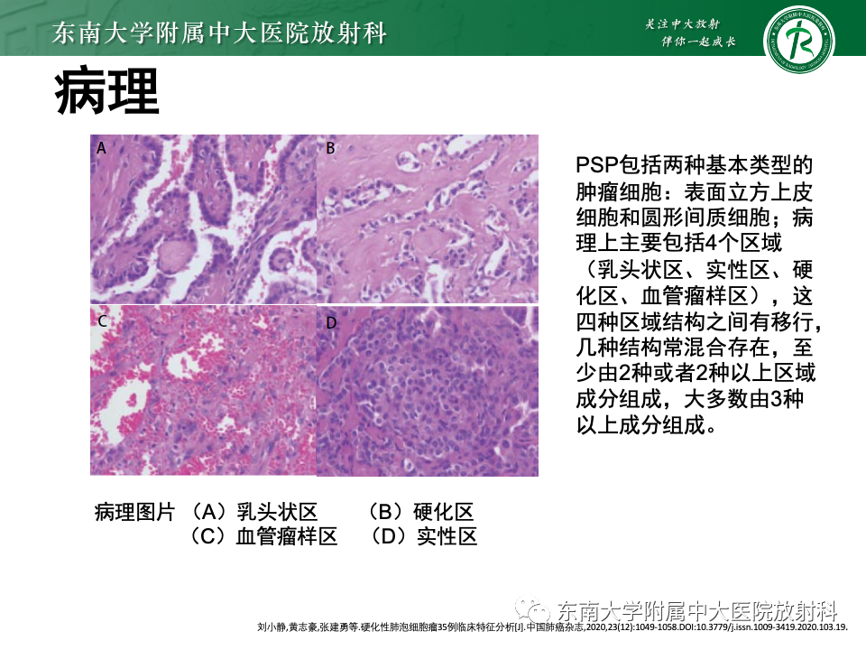 影像PPT - 【PPT】肺硬化性肺细胞瘤-7