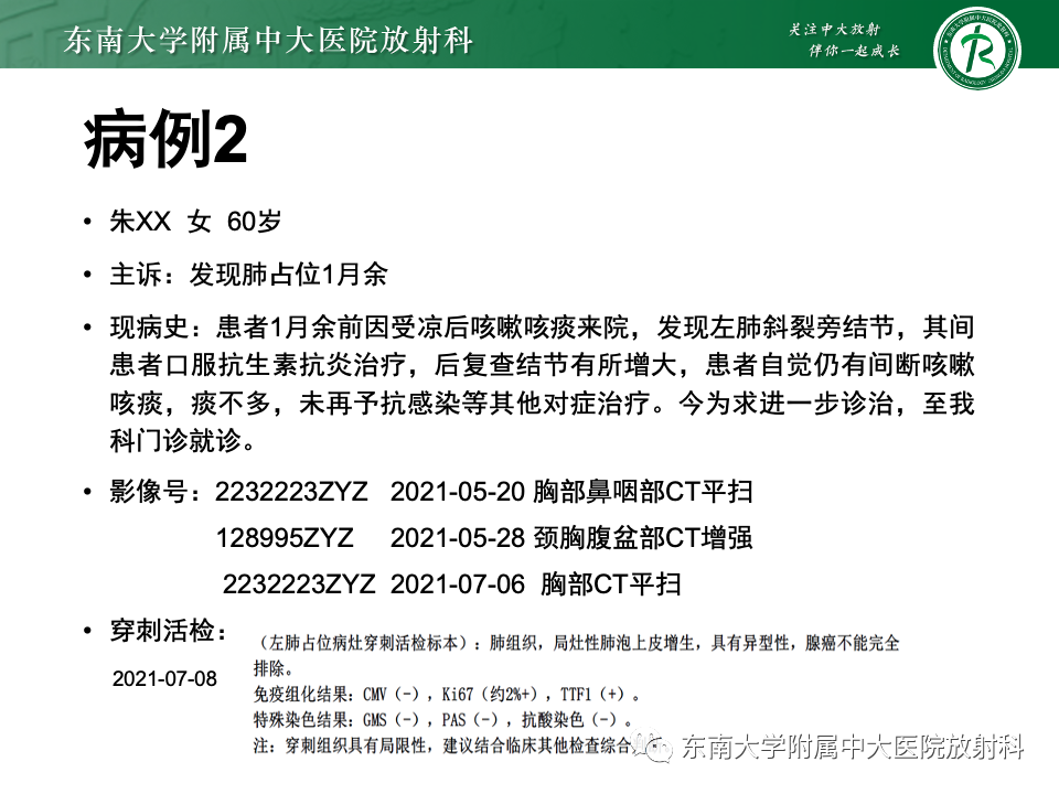 影像PPT - 【PPT】肺硬化性肺细胞瘤-13
