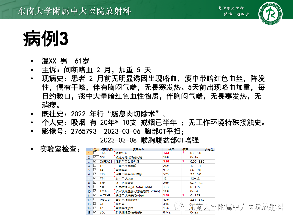 影像PPT - 【PPT】肺硬化性肺细胞瘤-18