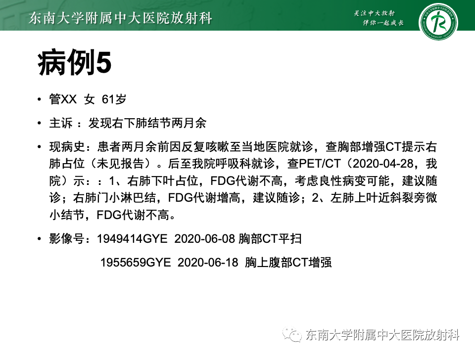 影像PPT - 【PPT】肺硬化性肺细胞瘤-30