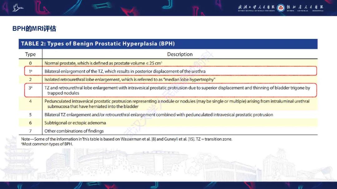 影像PPT - 【PPT】良性前列腺增生治疗前后MRI评估-11