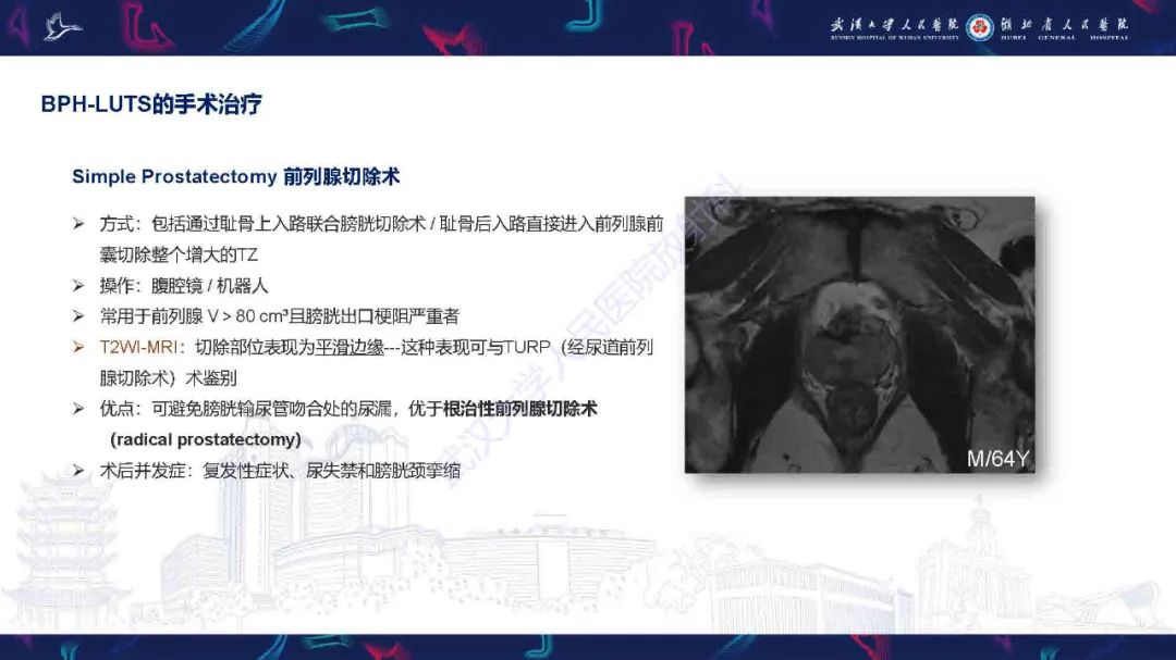 影像PPT - 【PPT】良性前列腺增生治疗前后MRI评估-18