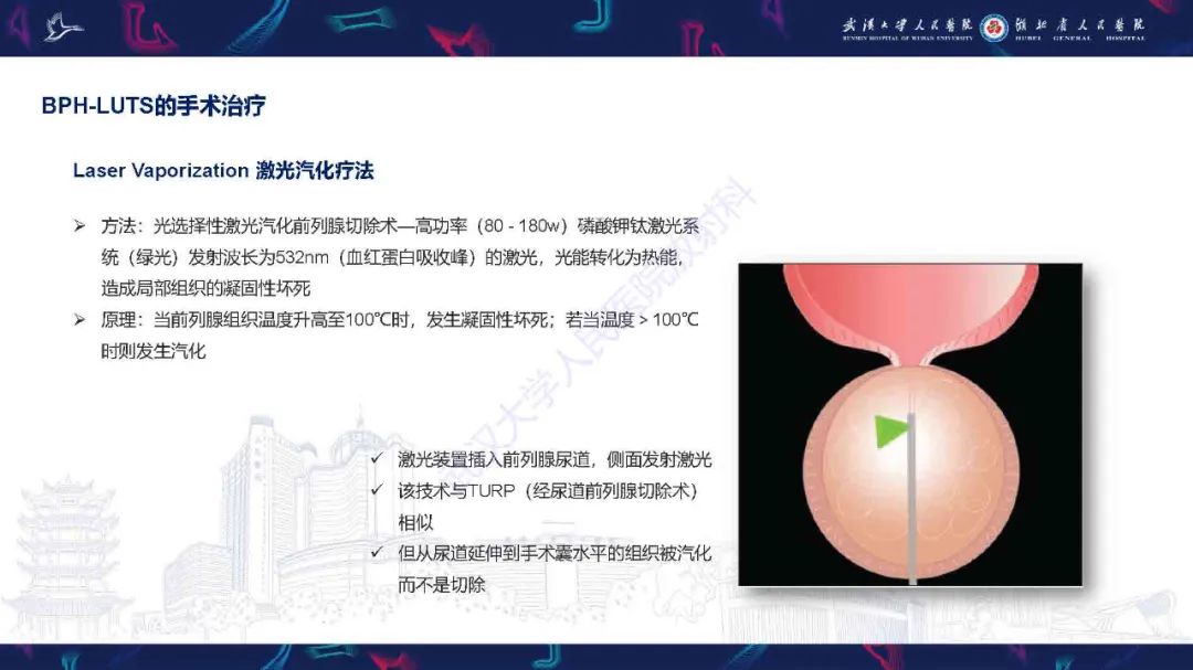 影像PPT - 【PPT】良性前列腺增生治疗前后MRI评估-31