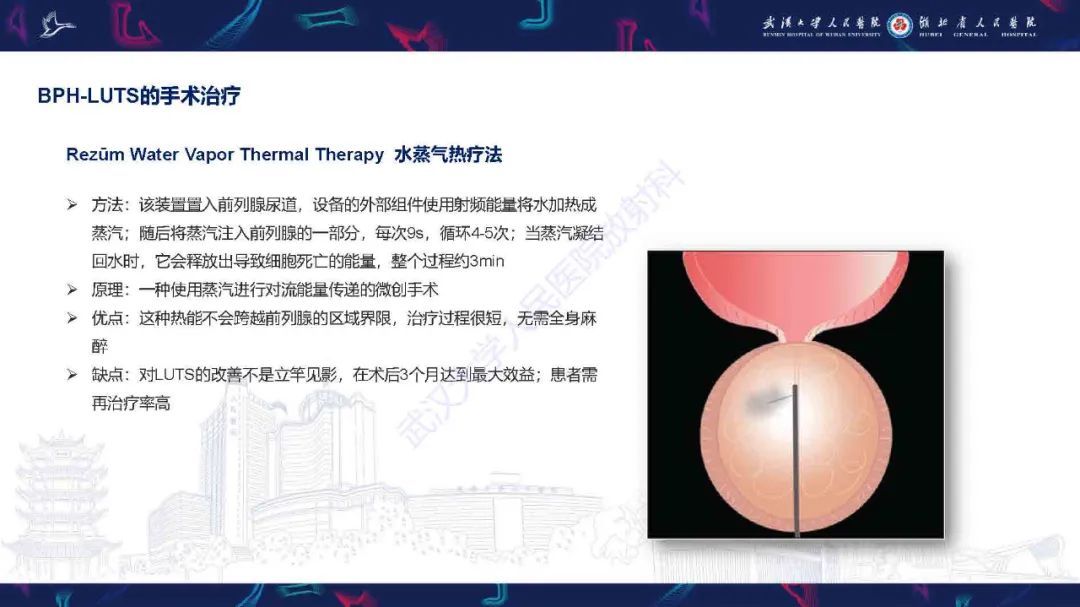 影像PPT - 【PPT】良性前列腺增生治疗前后MRI评估-40