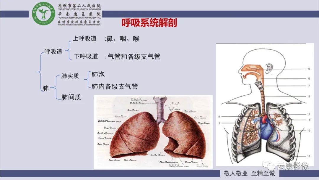 影像PPT - 【PPT】肺水肿的影像诊断-8