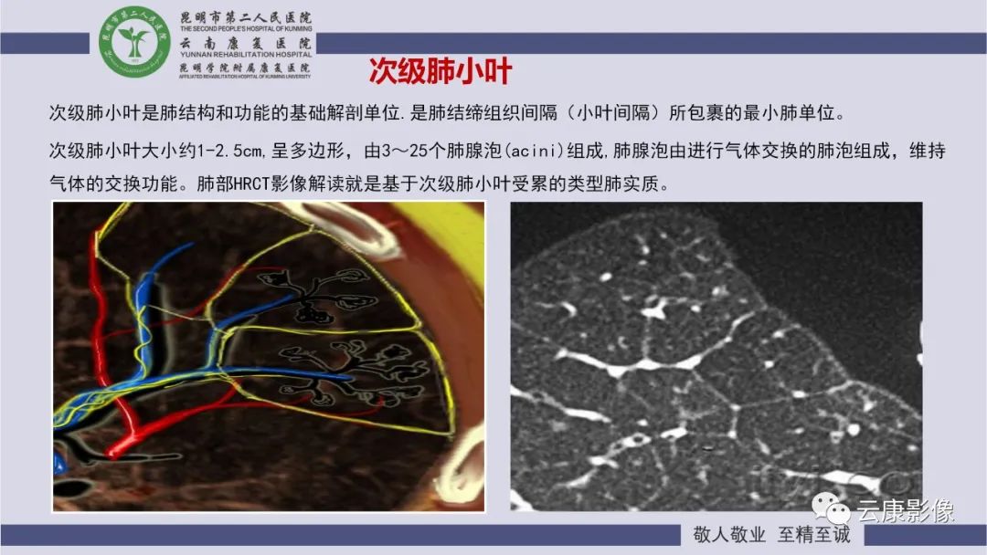影像PPT - 【PPT】肺水肿的影像诊断-10