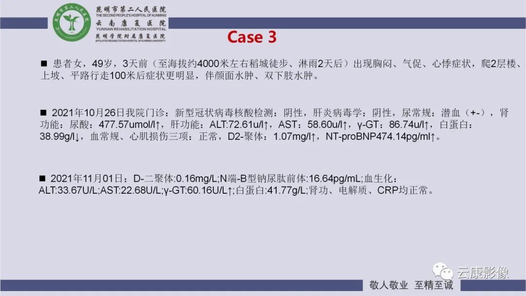 影像PPT - 【PPT】肺水肿的影像诊断-25