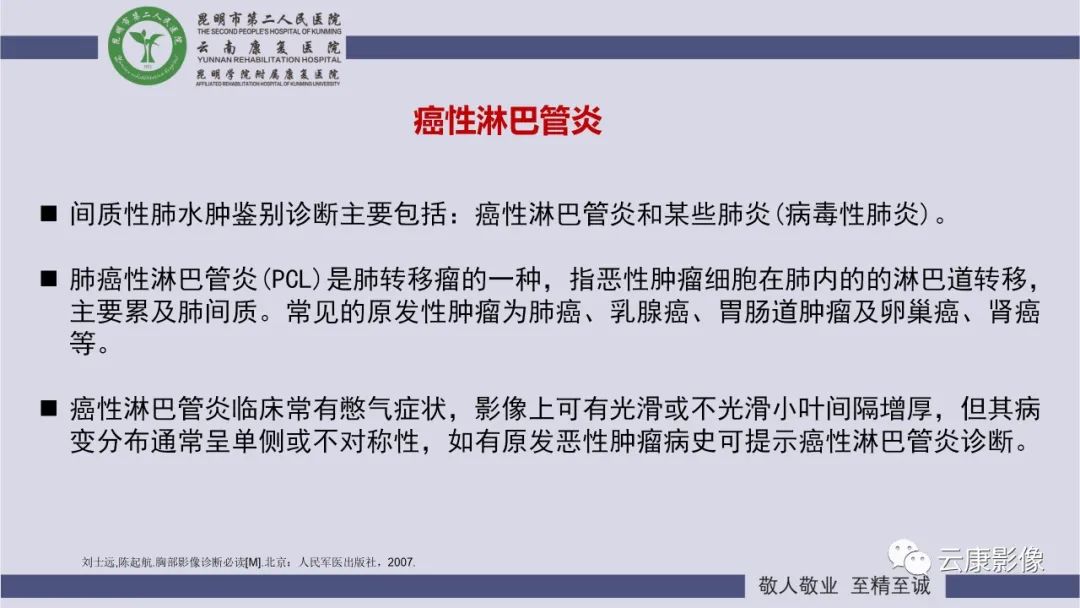 影像PPT - 【PPT】肺水肿的影像诊断-30