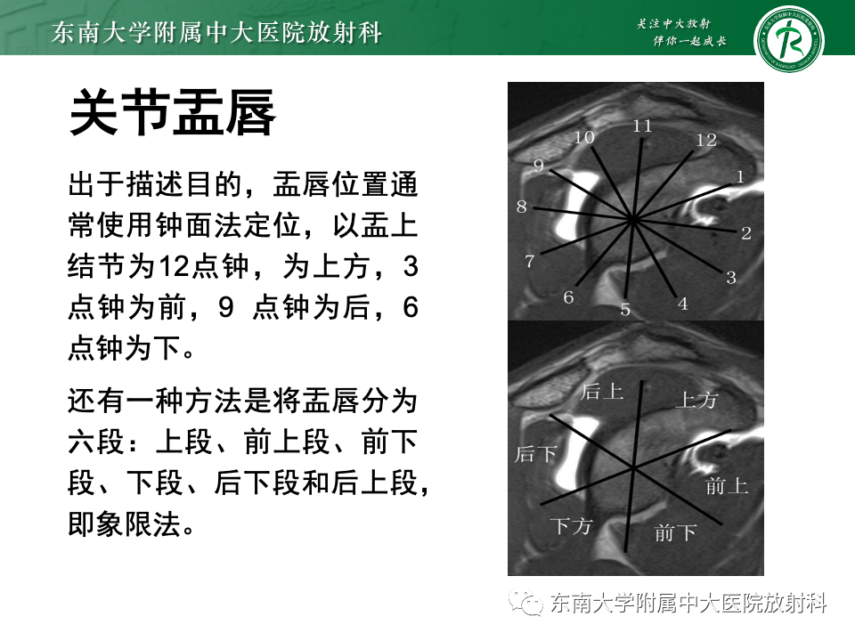 影像PPT - 【PPT】肩关节盂唇损伤-5