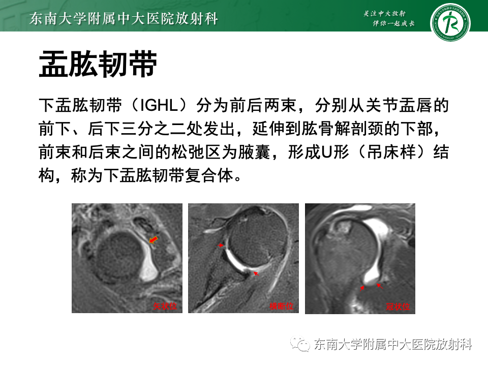 影像PPT - 【PPT】肩关节盂唇损伤-8