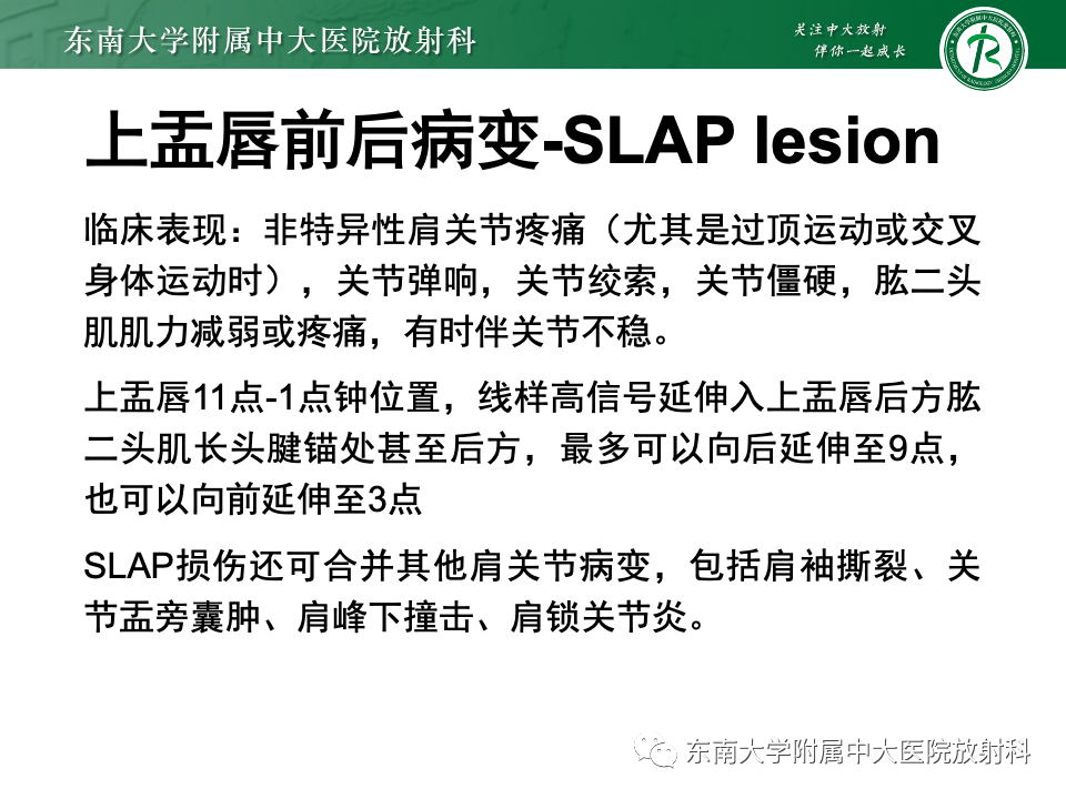 影像PPT - 【PPT】肩关节盂唇损伤-33