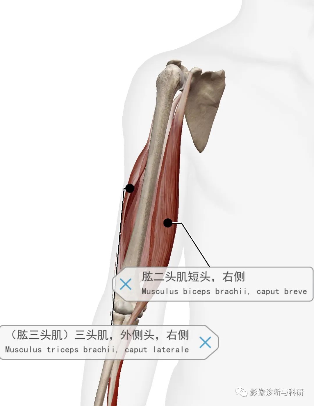 影像PPT - 上臂肌群分组、对应解剖-2 影像PPT - 上臂肌群分组、对应解剖-2