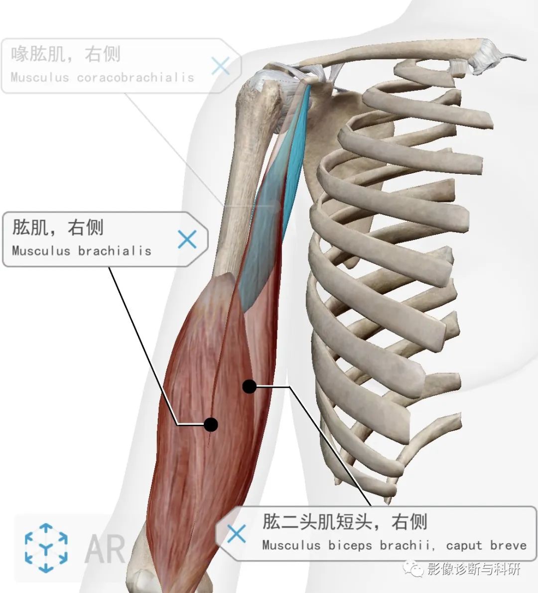 影像PPT - 上臂肌群分组、对应解剖-1 影像PPT - 上臂肌群分组、对应解剖-1