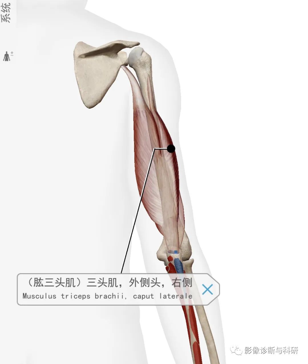 影像PPT - 上臂肌群分组、对应解剖-3 影像PPT - 上臂肌群分组、对应解剖-3