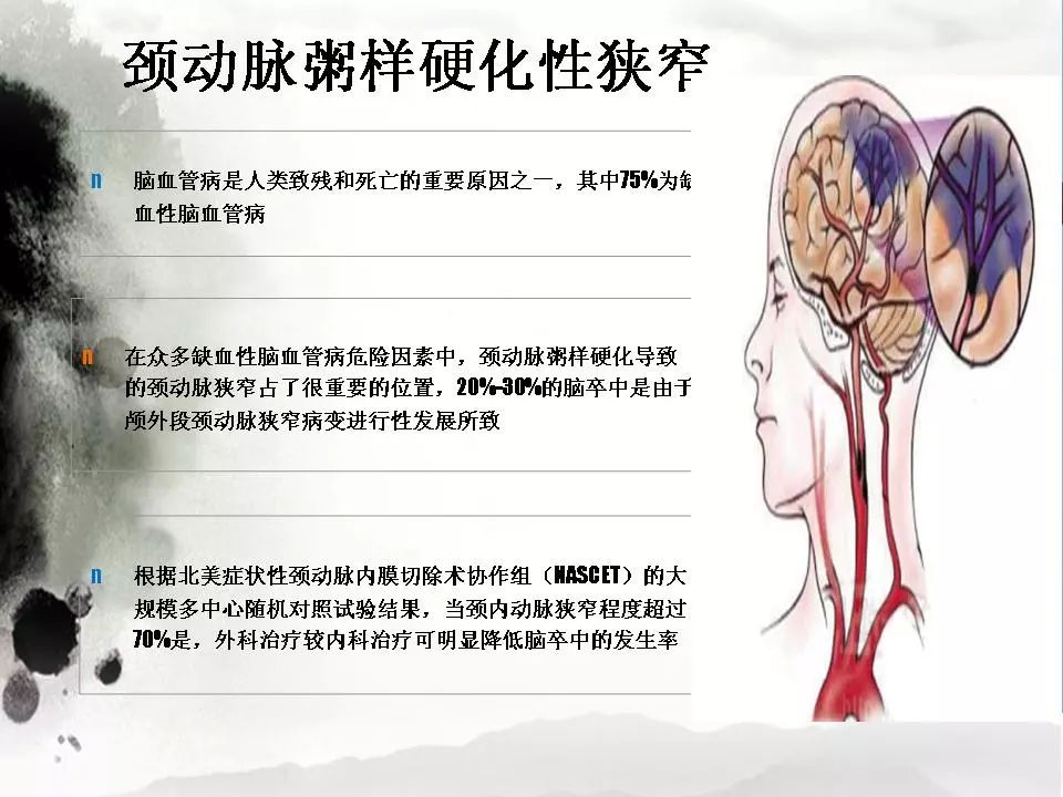 影像PPT - 【PPT】颈动脉CTA及MRA评价-16
