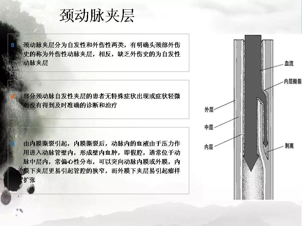 影像PPT - 【PPT】颈动脉CTA及MRA评价-30
