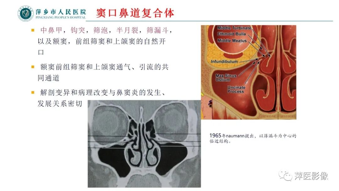 影像PPT - 【PPT】鼻/鼻窦病变影像诊断-5