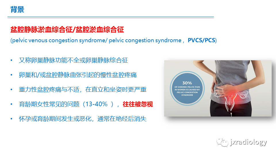 影像PPT - 【PPT】盆腔静脉淤血综合征：检查、分级及血管内治疗-2