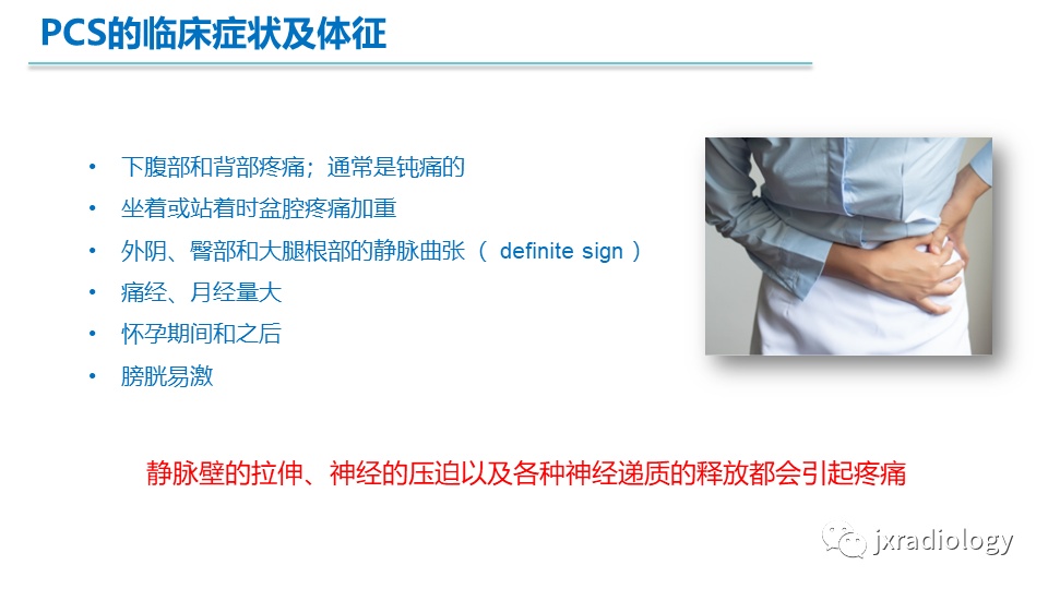影像PPT - 【PPT】盆腔静脉淤血综合征：检查、分级及血管内治疗-7