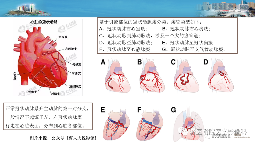 影像PPT - 【PPT】冠状动脉瘘的影像诊断-8