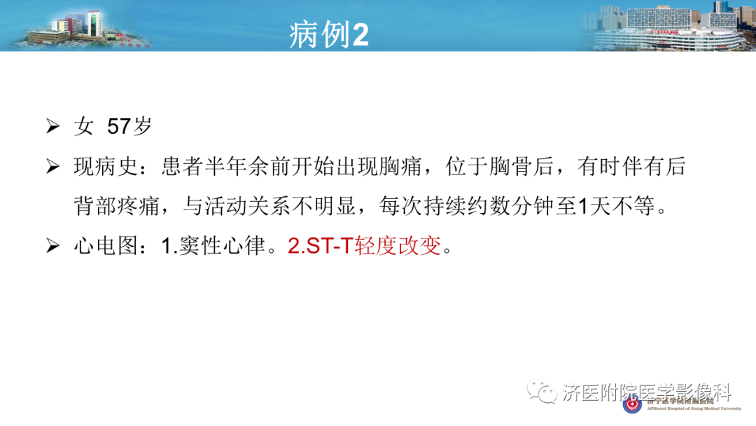 影像PPT - 【PPT】冠状动脉瘘的影像诊断-10