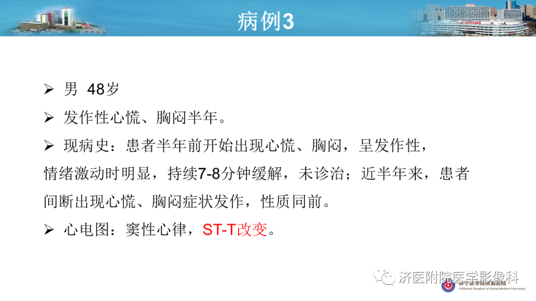 影像PPT - 【PPT】冠状动脉瘘的影像诊断-12