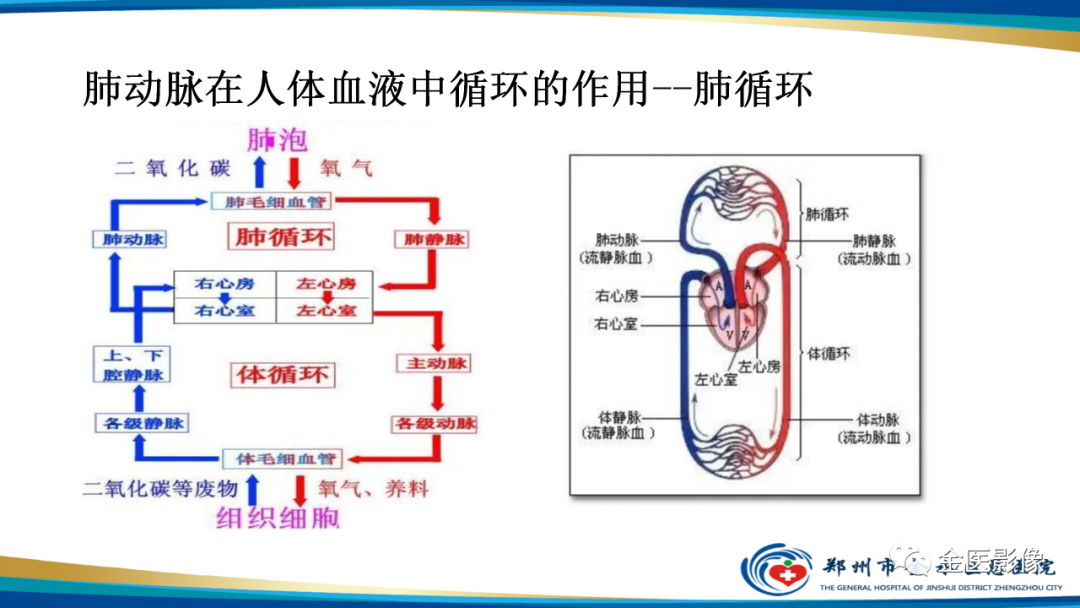 影像PPT - 【PPT】肺动脉栓塞及肺动脉CTA检查技术-2