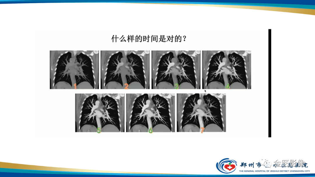 影像PPT - 【PPT】肺动脉栓塞及肺动脉CTA检查技术-21