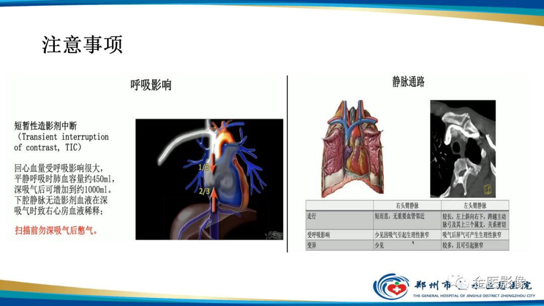 影像PPT - 【PPT】肺动脉栓塞及肺动脉CTA检查技术-27