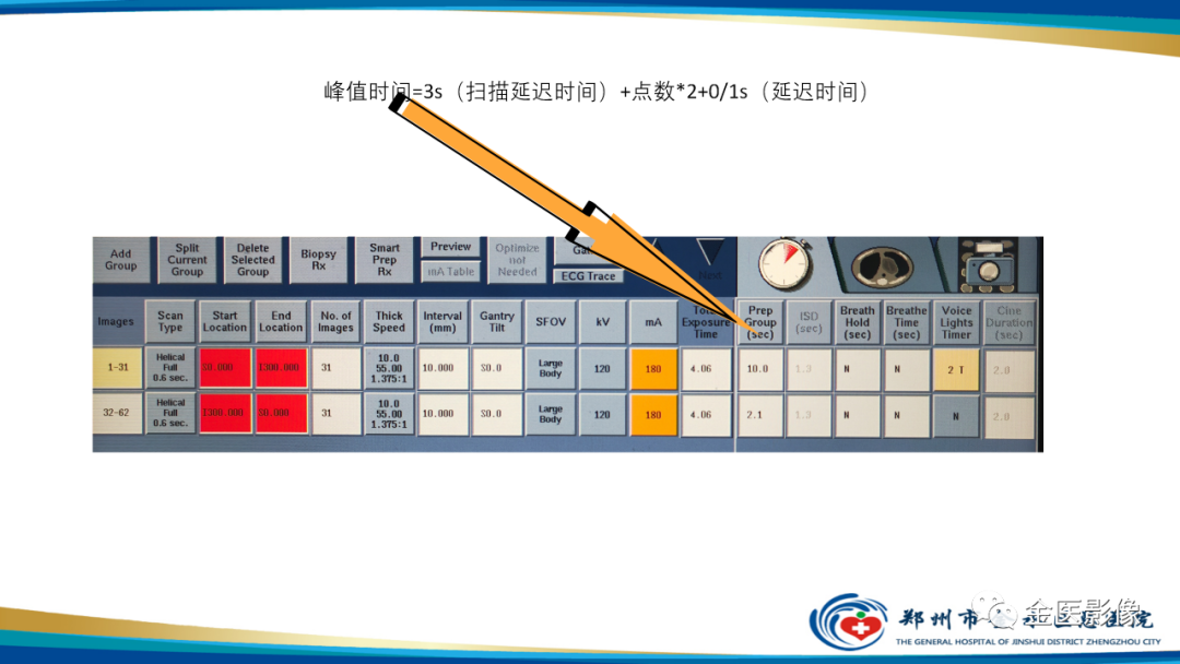 影像PPT - 【PPT】肺动脉栓塞及肺动脉CTA检查技术-33