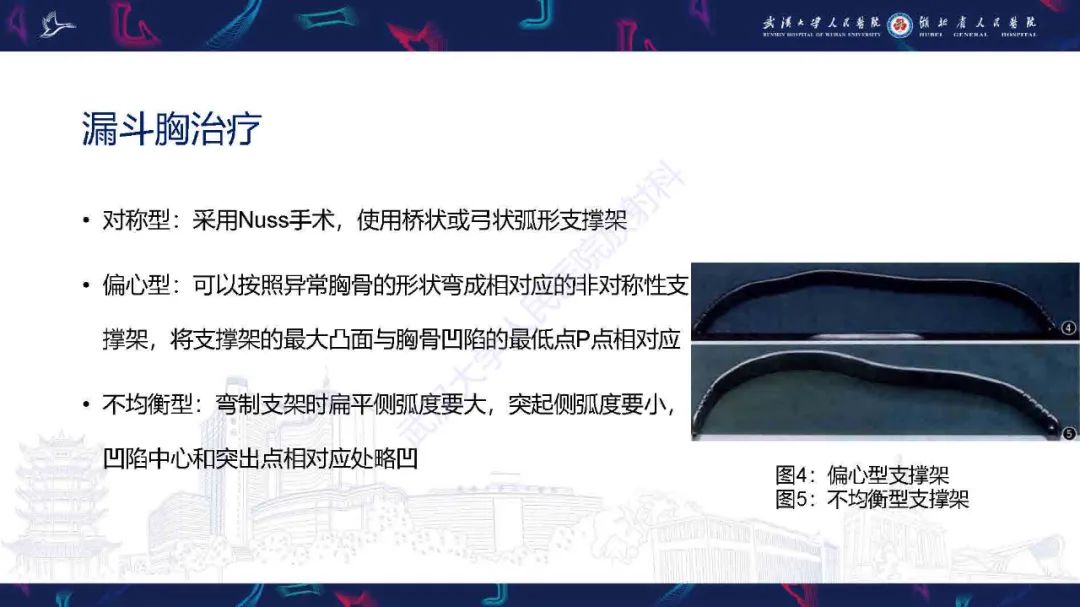 影像PPT - 【PPT】儿童先天性胸廓畸形CT诊断-12
