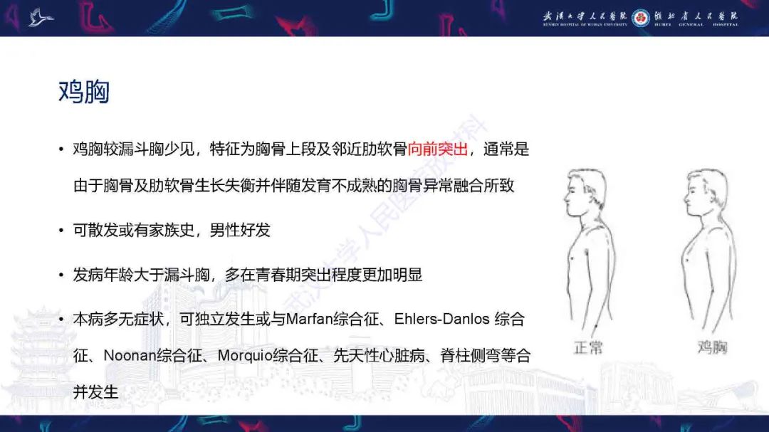 影像PPT - 【PPT】儿童先天性胸廓畸形CT诊断-14