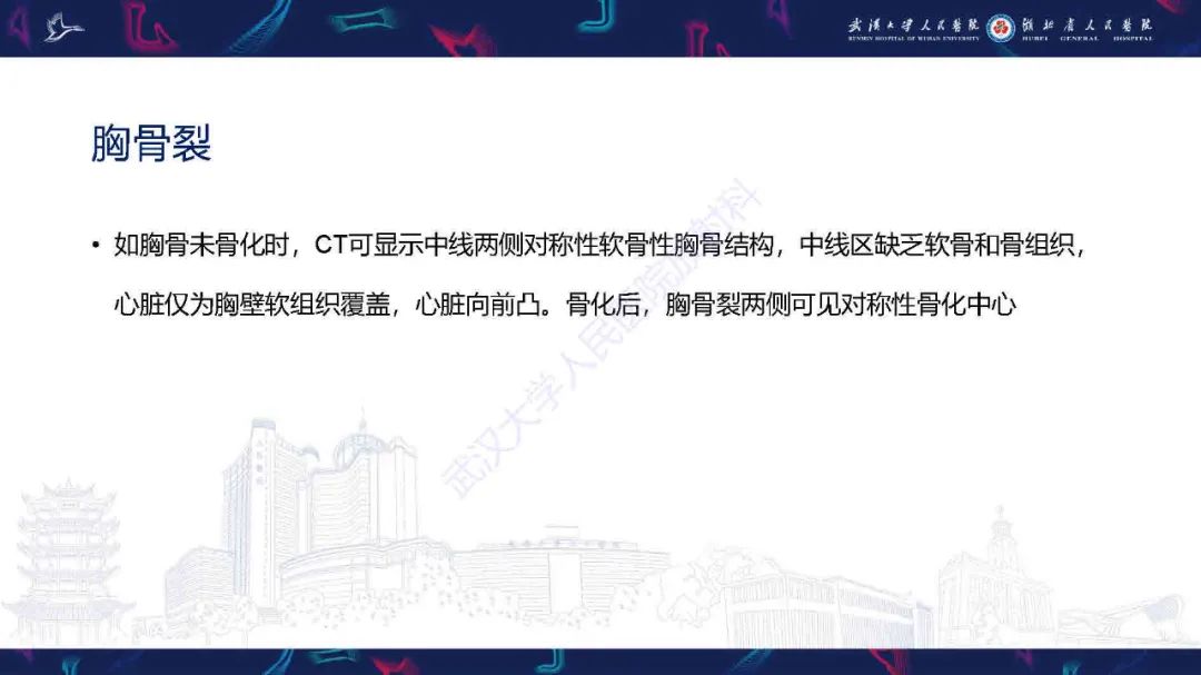 影像PPT - 【PPT】儿童先天性胸廓畸形CT诊断-24