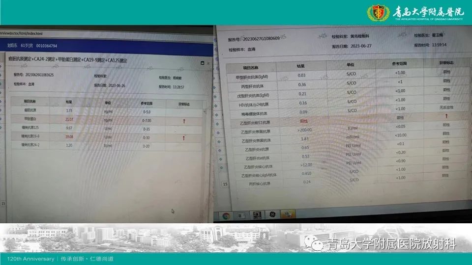 影像PPT - 【PPT】肝细胞癌-10